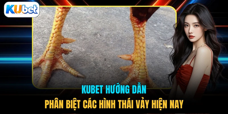 KUBET hướng dẫn phân biệt các hình thái vảy hiện nay